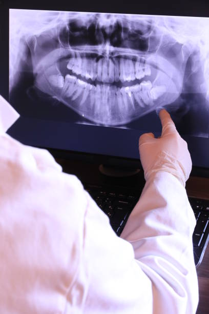 Best Emergency Treatment for Toothache in South Boston, VA