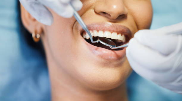 Best Emergency Root Canal Treatment in South Boston, VA