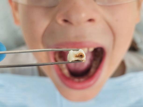 Best Walk-In Emergency Dentist in South Boston, VA